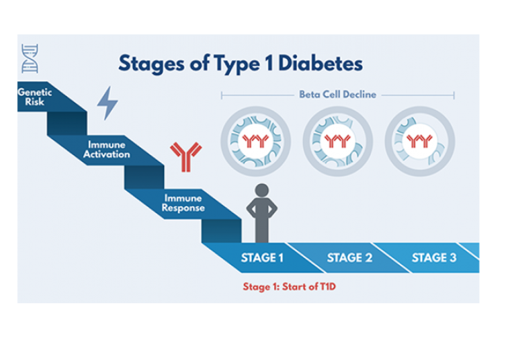 Stadia type 1 diabetes